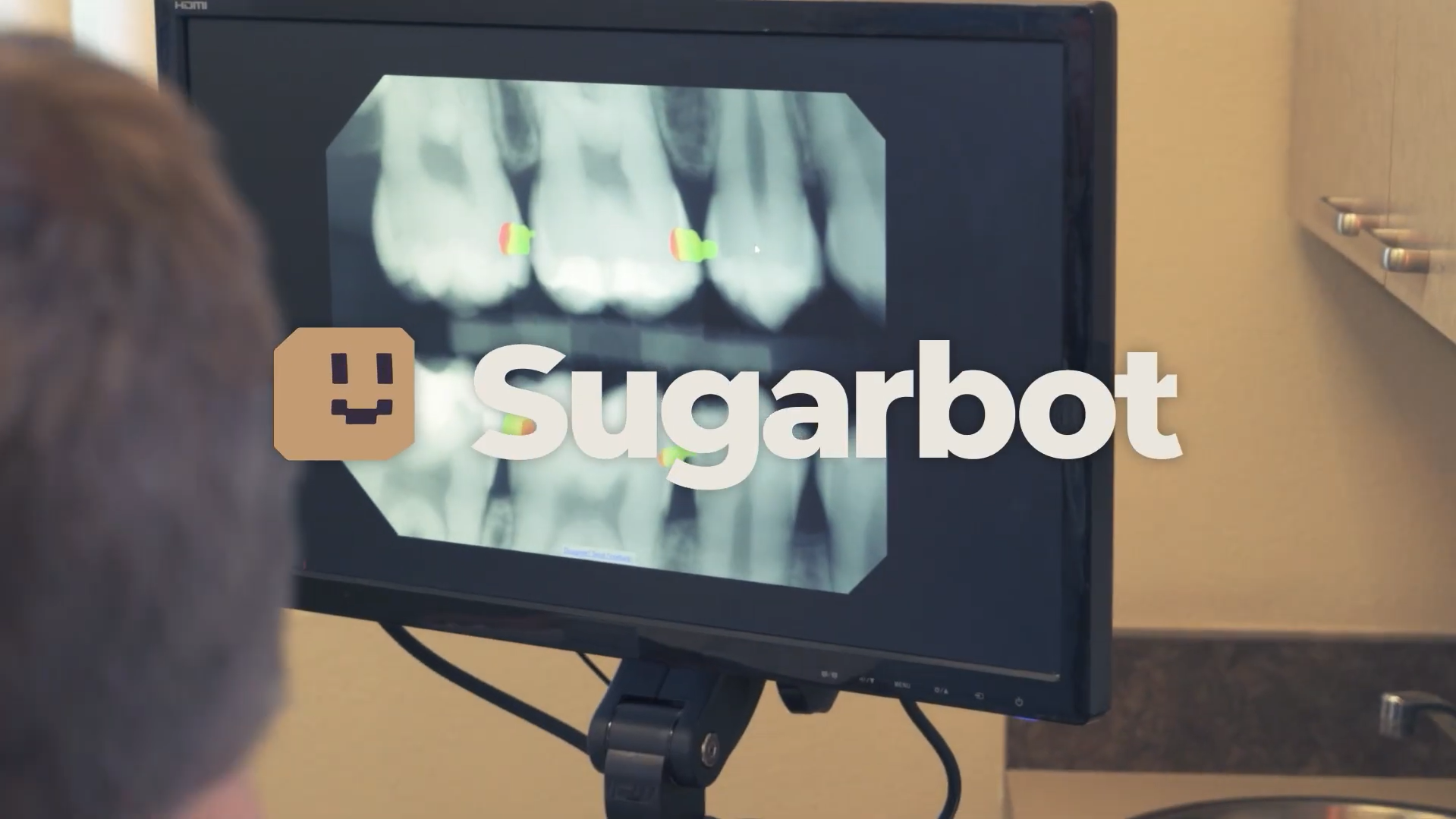 Sugarbot overview (thumbnail)